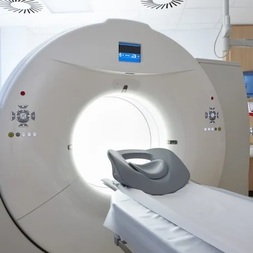 tomografie computerizată